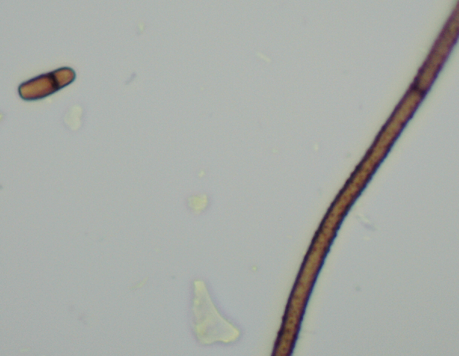 fungal strand and cyst.png